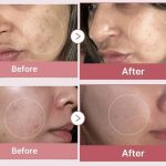 سرم روشن کننده پپتاید و PDRN مدی کیوب