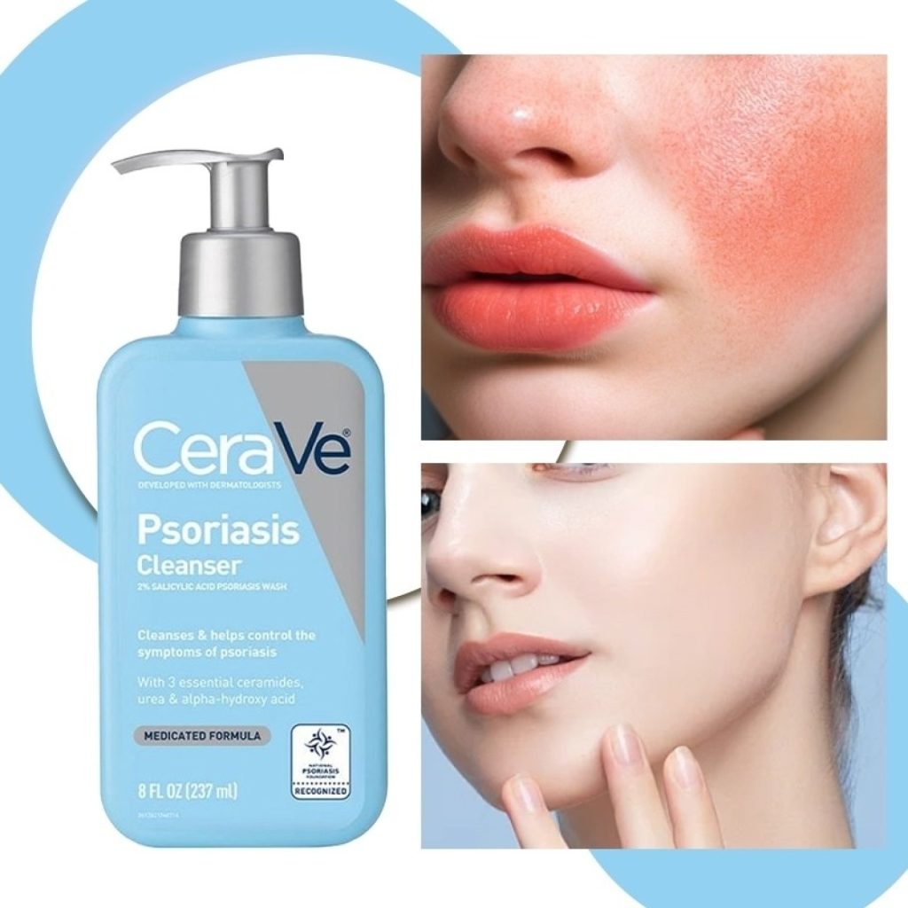 شوینده پسوریازیس سراوی CeraVe 1 img 1920x 67b63e8fdf8717 37947098 76092105