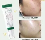 سرم ضدلک شفاف کننده و ضد جای جوش دارک اسپات اکسیس وای Axis-Y - Image 5