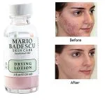 لوسیون ضد جوش Drying Lotion ماریو بدسکو Mariobadescu - Image 4