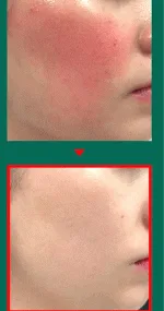 ژل التیام بخش Real Cica 92% سام بای می Some by mi - Image 2