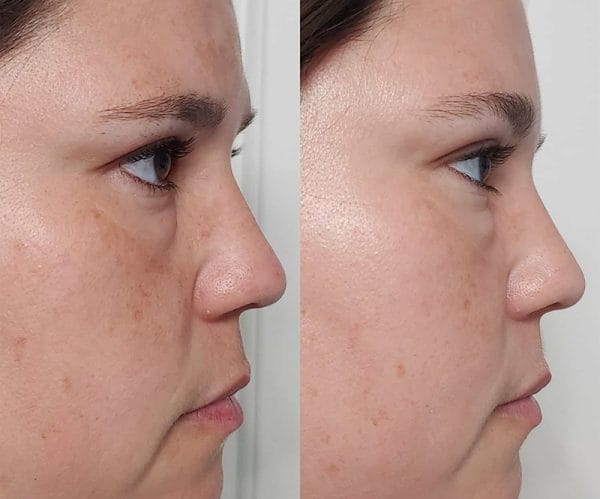 PaulasChoice LiquidExfoliant3 min