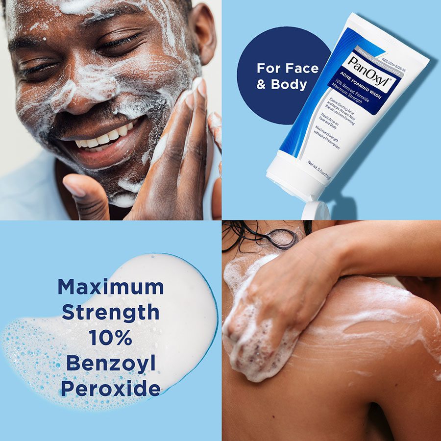 فوم شوینده ضد جوش بنزوئیل پروکساید 10% پانوکسیل Panoxyl 1 10PercentWashPDP 05