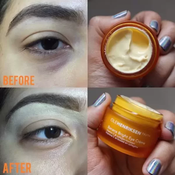 3 Ole Henriksen Banana Bright Eye Creme Before After
