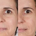 سرم لیفت کننده Resveratrol کدلی Caudalie - Image 3