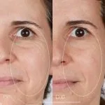 ژل کرم دور چشم لیفتینگ Resveratrol کدلی Caudalie - Image 3