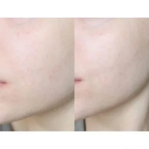 برنج آبرسان و روشن کننده آیم فرام Im From Rice Toner 8 700x700 1 1