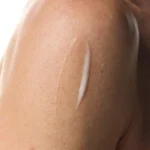 امولسیون نیاسینامید 5% صورت و بدن اوردینری